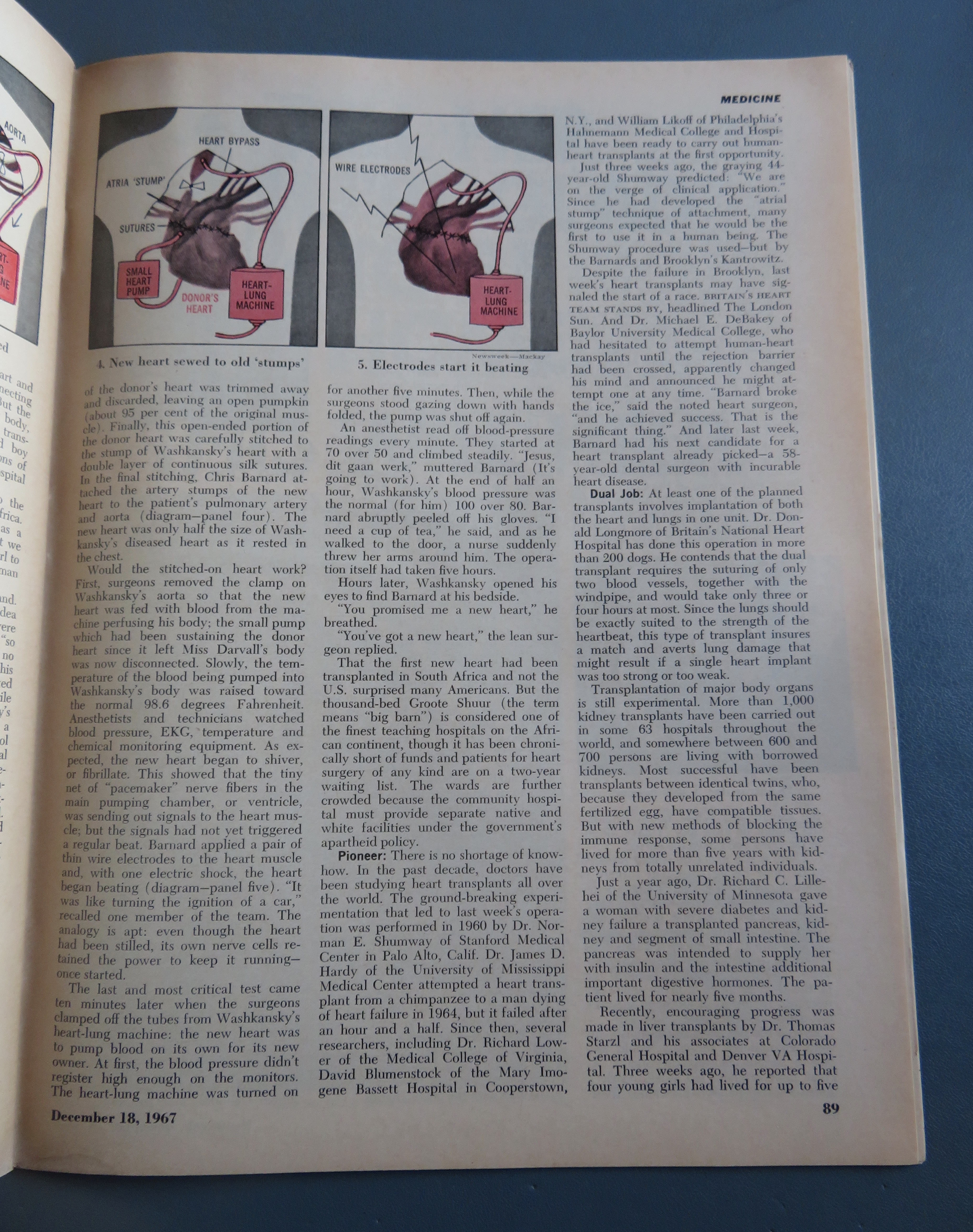 Newsweek Magazine December 18, 1967 Transplant Surgery