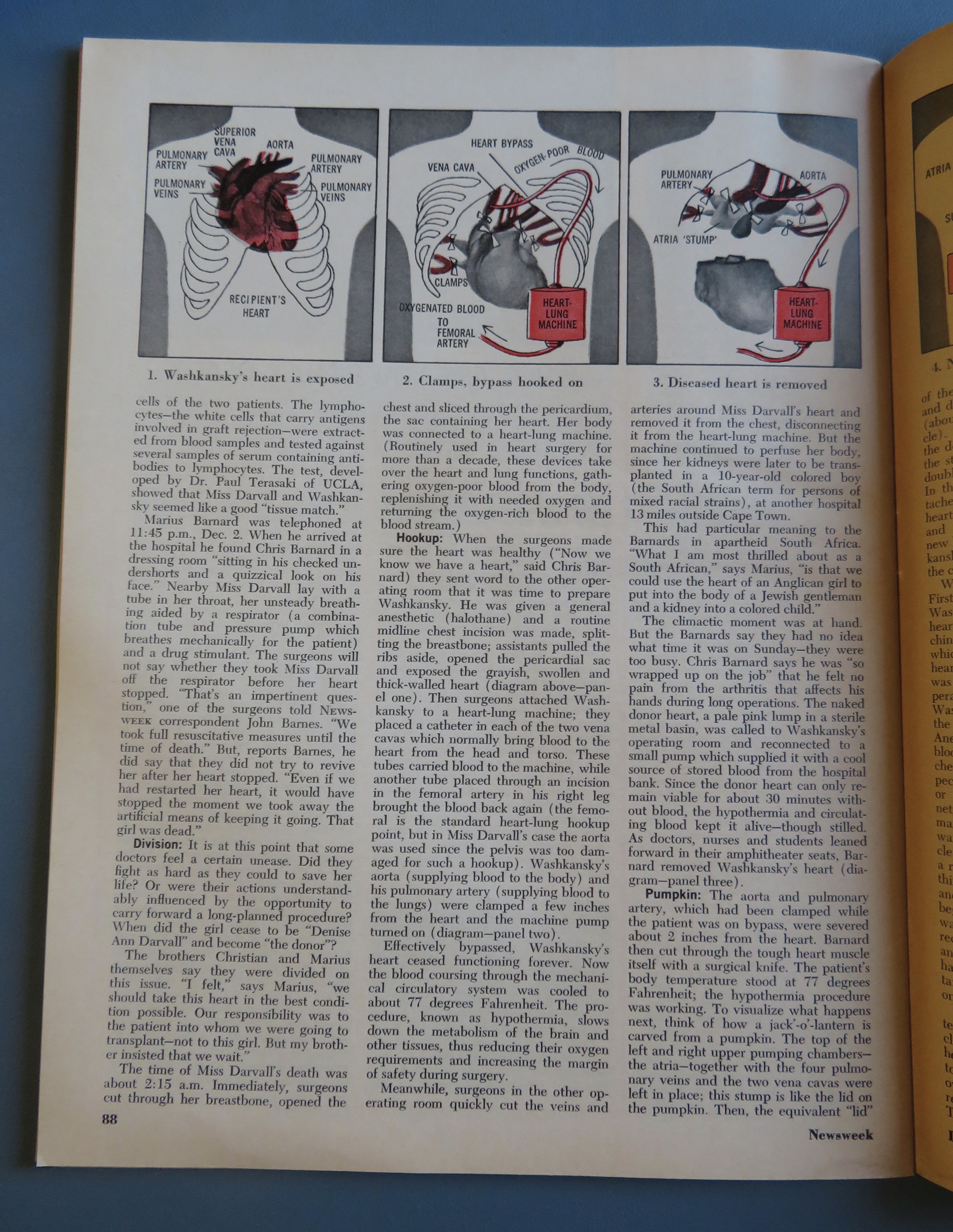 Newsweek Magazine December 18, 1967 Transplant Surgery