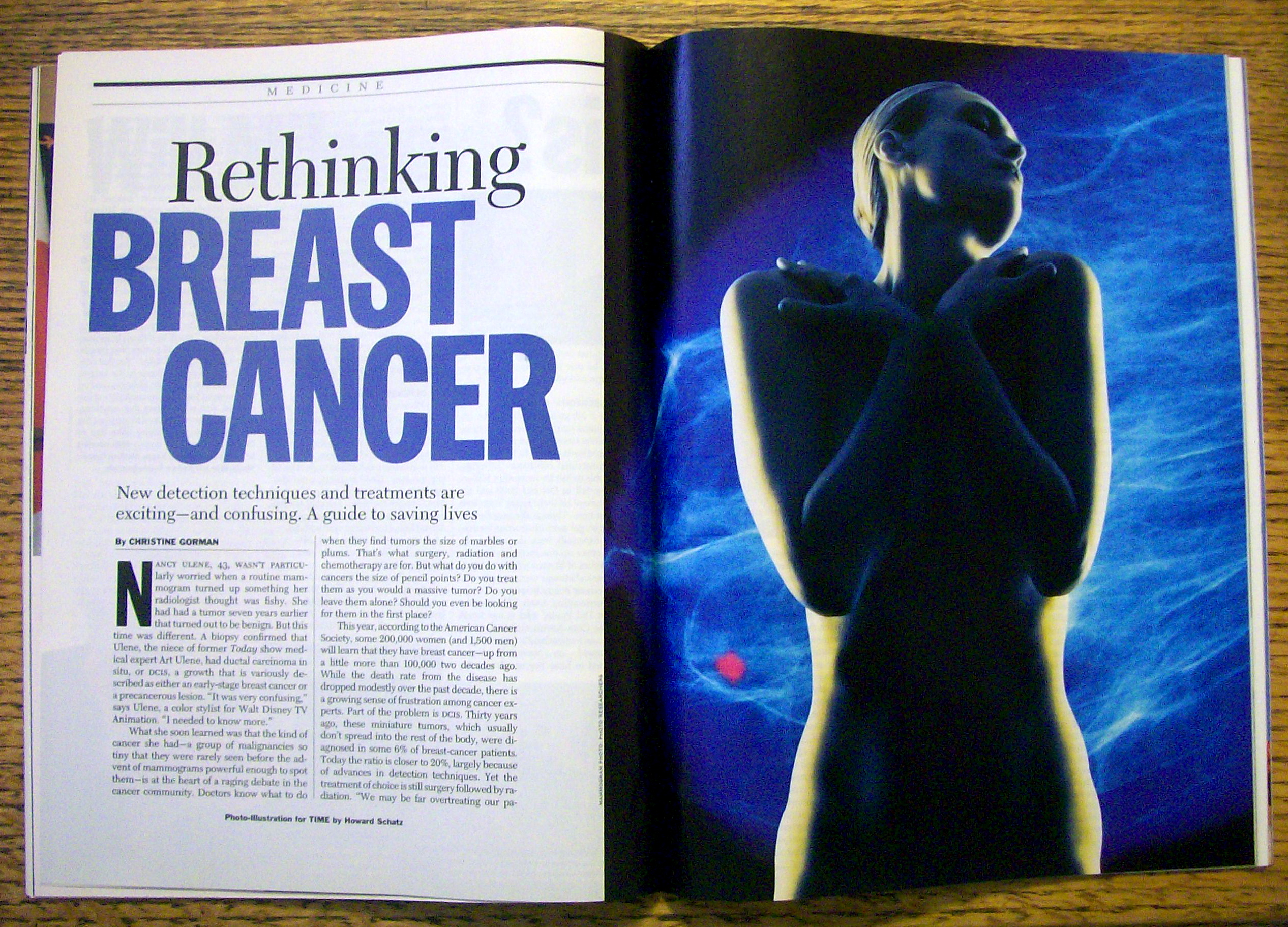 Time Magazine February 18, 2002 Breast Cancer