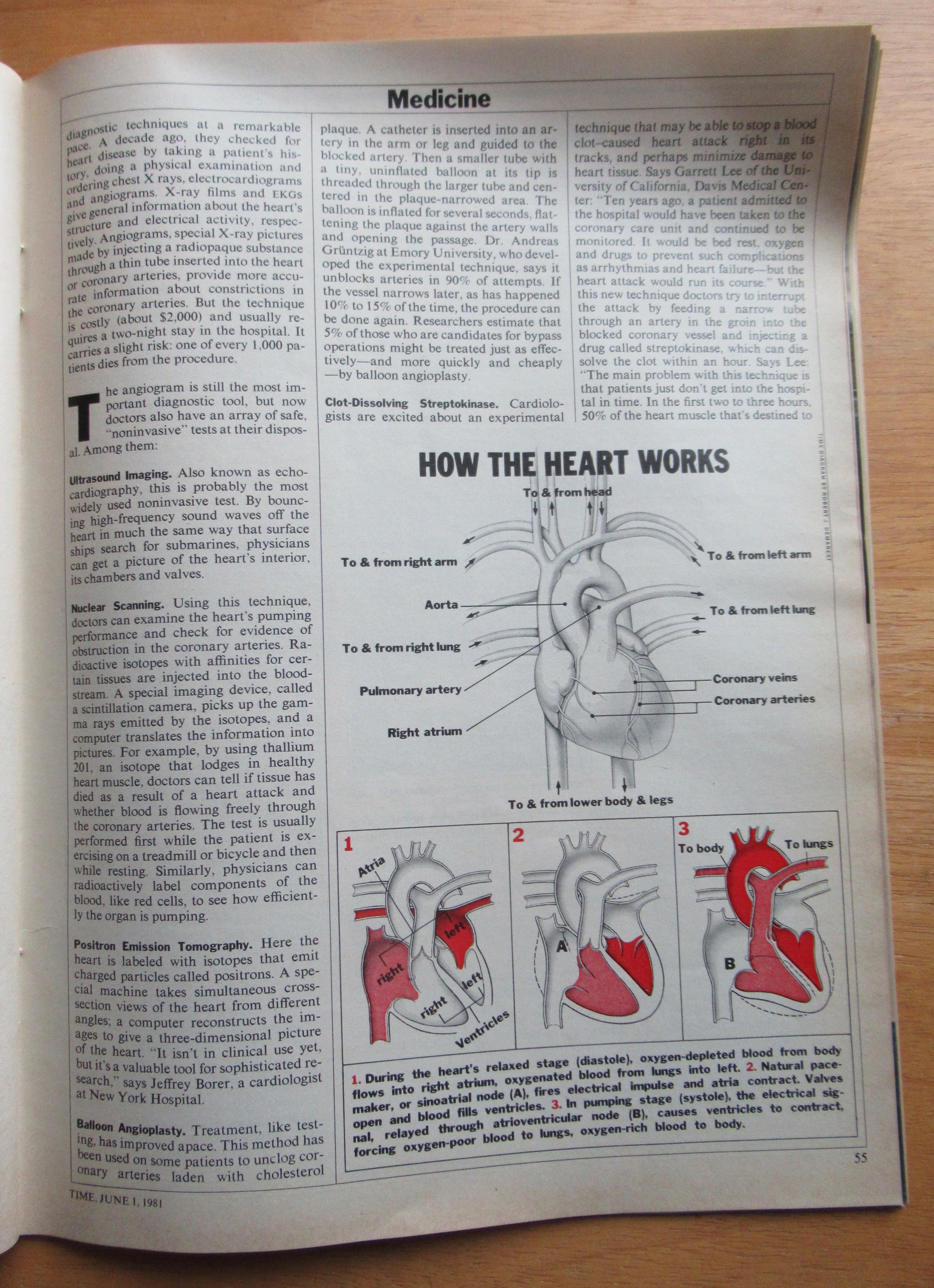 Time Magazine-June 1, 1981-Heart Attacks